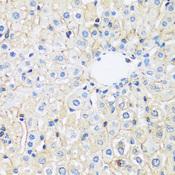 ARL4A / ARL4 Antibody - Immunohistochemistry of paraffin-embedded Rat liver using ARL4A Polyclonal Antibody at dilution of 1:100 (40x lens).
