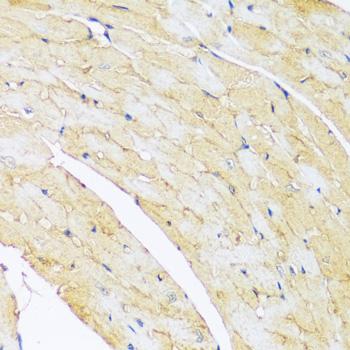 ARL4A / ARL4 Antibody - Immunohistochemistry of paraffin-embedded Mouse heart using ARL4A Polyclonal Antibody at dilution of 1:100 (40x lens).