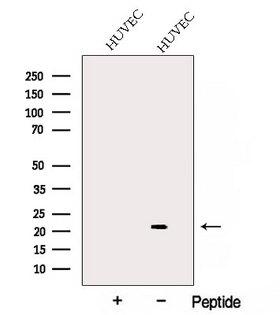 ARL4C Antibody - Western blot analysis of extracts of COLO205 cells using ARL4C antibody. The lane on the left was treated with blocking peptide.