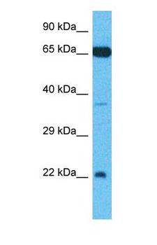 ARL4C Antibody - Western blot of ARL4C Antibody with human Fetal Kidney lysate.  This image was taken for the unconjugated form of this product. Other forms have not been tested.