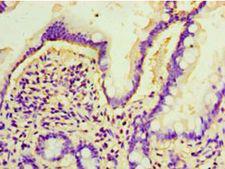 ARL4D Antibody - Immunohistochemistry of paraffin-embedded human small intestine using antibody at 1:100 dilution.  This image was taken for the unconjugated form of this product. Other forms have not been tested.