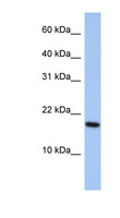 ARL5A / ARL5 Antibody - ARL5A antibody Western blot of HeLa lysate. This image was taken for the unconjugated form of this product. Other forms have not been tested.