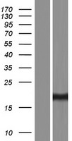 ARL5A / ARL5 Protein - Western validation with an anti-DDK antibody * L: Control HEK293 lysate R: Over-expression lysate