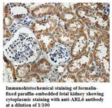 ARL6 Antibody - Immunohistochemistry of ARL6 antibody
