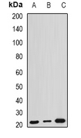 ARL6 Antibody - Western blot analysis of ARL6 expression in HEK293T (A); mouse kidney (B); mouse brain (C) whole cell lysates.