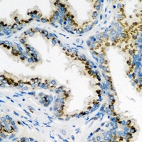 ARL6 Antibody - Immunohistochemical analysis of ARL6 staining in human prostate formalin fixed paraffin embedded tissue section. The section was pre-treated using heat mediated antigen retrieval with sodium citrate buffer (pH 6.0). The section was then incubated with the antibody at room temperature and detected using an HRP conjugated compact polymer system. DAB was used as the chromogen. The section was then counterstained with hematoxylin and mounted with DPX.