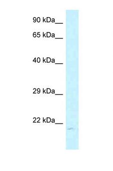 ARL6IP1 / ARMER Antibody - ARL6IP1 / ARMER antibody Western blot of MCF7 Cell lysate. Antibody concentration 1 ug/ml.  This image was taken for the unconjugated form of this product. Other forms have not been tested.