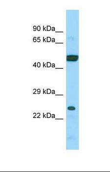 ARL6IP4 Antibody - Western blot of Human 721_B. ARL6IP4 antibody dilution 1.0 ug/ml.  This image was taken for the unconjugated form of this product. Other forms have not been tested.