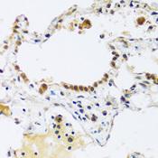 ARL6IP4 Antibody - Immunohistochemistry of paraffin-embedded Human lung using ARL6IP4 Polyclonal Antibody at dilution of 1:100 (40x lens).