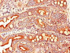 ARL6IP5 Antibody - Immunohistochemistry of paraffin-embedded human small intestine tissue using ARL6IP5 Antibody at dilution of 1:100
