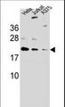 ARL6IP6 Antibody - ARL6IP6Antibody western blot of A375,HeLa,Jurkat cell line lysates (35 ug/lane). The ARL6IP6 antibody detected the ARL6IP6 protein (arrow).