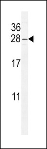 ARL8 / ARL5B Antibody - ARL8 Antibody western blot of CEM cell line lysates (35 ug/lane). The ARL8 antibody detected the ARL8 protein (arrow).
