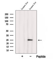 ARL8 / ARL5B Antibody - Western blot analysis of extracts of human liver tissue using ARL5B antibody. The lane on the left was treated with blocking peptide.