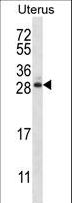 ARL8A Antibody - ARL8A Antibody western blot of human normal Uterus tissue lysates (35 ug/lane). The ARL8A antibody detected the ARL8A protein (arrow).