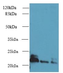 ARL8A + ARL8B Antibody - Western blot. All lanes: ARL8B antibody at 4 ug/ml. Lane 1: Mouse brain tissue. Lane 2: NIH/3T3 whole cell lysate. Lane 3: Jurkat whole cell lysate. Secondary Goat polyclonal to Rabbit IgG at 1:10000 dilution. Predicted band size: 22 kDa. Observed band size: 22 kDa.