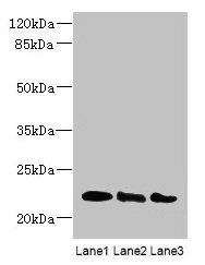 ARL8A + ARL8B Antibody - Western blot All lanes: ARL8B antibody at 4µg/ml Lane 1: Mouse brain tissue Lane 2: NIH/3T3 whole cell lysate Lane 3: Jurkat whole cell lysate Secondary Goat polyclonal to rabbit IgG at 1/10000 dilution Predicted band size: 22, 19 kDa Observed band size: 22 kDa