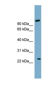 ARL8B Antibody - ARL8B / ARL8A antibody Western blot of COLO205 cell lysate. This image was taken for the unconjugated form of this product. Other forms have not been tested.