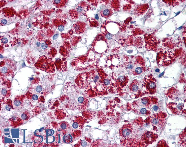 ARL8B Antibody - Anti-ARL8B / ARL8A antibody IHC of human adrenal. Immunohistochemistry of formalin-fixed, paraffin-embedded tissue after heat-induced antigen retrieval. Antibody concentration 5 ug/ml.  This image was taken for the unconjugated form of this product. Other forms have not been tested.