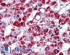 ARL8B Antibody - Anti-ARL8B / ARL8A antibody IHC of human adrenal. Immunohistochemistry of formalin-fixed, paraffin-embedded tissue after heat-induced antigen retrieval. Antibody concentration 5 ug/ml.  This image was taken for the unconjugated form of this product. Other forms have not been tested.