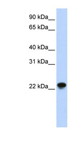 ARL8B Antibody - ARL8B / ARL8A antibody Western blot of Fetal Muscle lysate. This image was taken for the unconjugated form of this product. Other forms have not been tested.