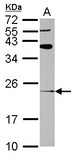 ARL8B Antibody - Sample (30 ug of whole cell lysate) A: U87-MG 12% SDS PAGE ARL8B / ARL8A antibody diluted at 1:1000