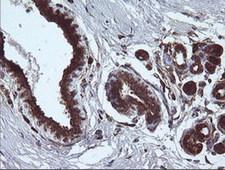 ARMC1 Antibody - IHC of paraffin-embedded Human breast tissue using anti-ARMC1 mouse monoclonal antibody.