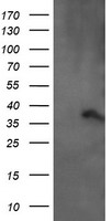 ARMC1 Antibody - HEK293T cells were transfected with the pCMV6-ENTRY control (Left lane) or pCMV6-ENTRY ARMC1 (Right lane) cDNA for 48 hrs and lysed. Equivalent amounts of cell lysates (5 ug per lane) were separated by SDS-PAGE and immunoblotted with anti-ARMC1.