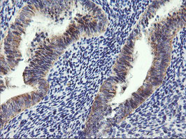 ARMC1 Antibody - IHC of paraffin-embedded Human endometrium tissue using anti-ARMC1 mouse monoclonal antibody.
