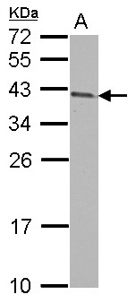 ARMC1 Antibody - Sample (30 ug of whole cell lysate) A: Jurkat 12% SDS PAGE ARMC1 antibody diluted at 1:1000