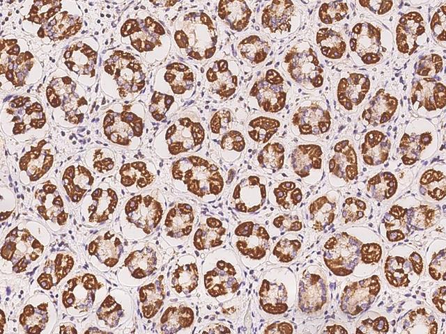 ARMC1 Antibody - Immunochemical staining of human ARMC1 in human stomach with rabbit polyclonal antibody at 1:100 dilution, formalin-fixed paraffin embedded sections.