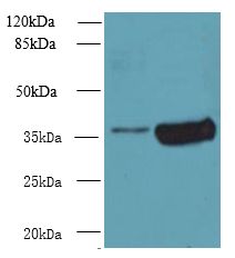 ARMC10 Antibody - Western blot. All lanes: ARMC10 antibody at 5 ug/ml. Lane 1: 293T whole cell lysate. Lane 2: Mouse liver tissue. Secondary Goat polyclonal to Rabbit IgG at 1:10000 dilution. Predicted band size: 38 kDa. Observed band size: 38 kDa.