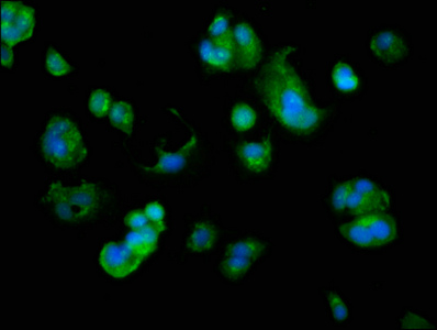 ARMC10 Antibody - Immunofluorescence staining of MCF-7 cells with ARMC10 Antibody at 1:166, counter-stained with DAPI. The cells were fixed in 4% formaldehyde, permeabilized using 0.2% Triton X-100 and blocked in 10% normal Goat Serum. The cells were then incubated with the antibody overnight at 4°C. The secondary antibody was Alexa Fluor 488-congugated AffiniPure Goat Anti-Rabbit IgG(H+L).