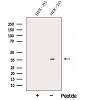 ARMC10 Antibody - Western blot analysis of extracts of HEK293 cells using ARMC10 antibody. The lane on the left was treated with blocking peptide.