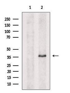 ARMC10 Antibody