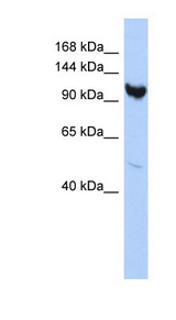 ARMC3 Antibody - ARMC3 antibody Western blot of HepG2 cell lysate. This image was taken for the unconjugated form of this product. Other forms have not been tested.