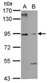 ARMC3 Antibody - Sample (30 ug of whole cell lysate) A: 293T B: HeLa 7.5% SDS PAGE ARMC3 antibody diluted at 1:1000