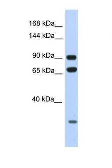 ARMC4 Antibody - ARMC4 antibody Western blot of HeLa Cell lysate. Antibody concentration 1 ug/ml.  This image was taken for the unconjugated form of this product. Other forms have not been tested.