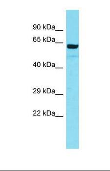 ARMC5 Antibody - Western blot of Human THP-1. ARMC5 antibody dilution 1.0 ug/ml.  This image was taken for the unconjugated form of this product. Other forms have not been tested.