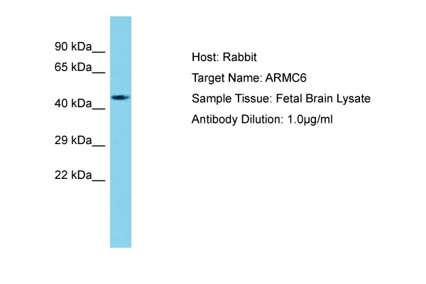 ARMC6 Antibody -  This image was taken for the unconjugated form of this product. Other forms have not been tested.
