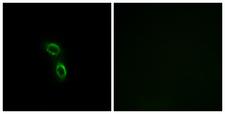 ARMC6 Antibody - Immunofluorescence analysis of A549 cells, using ARMC6 Antibody. The picture on the right is blocked with the synthesized peptide.