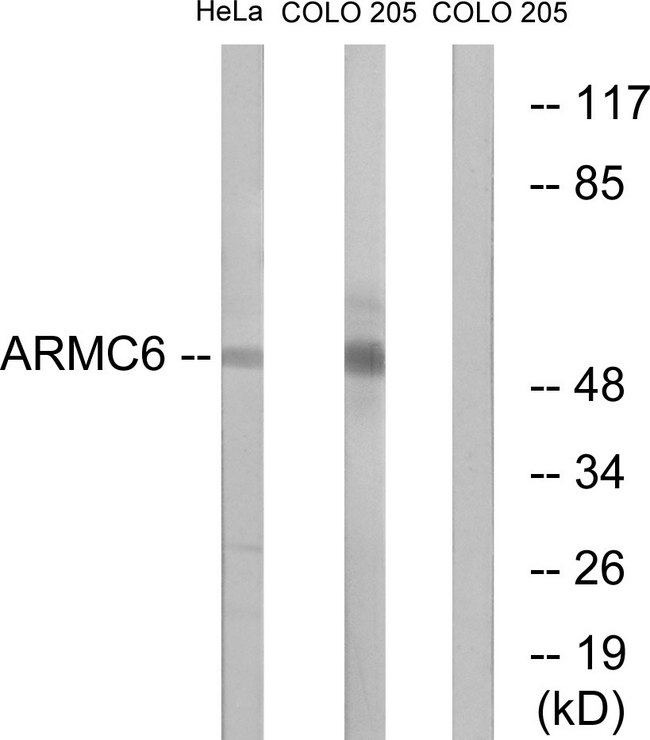 ARMC6 Antibody - Western blot analysis of lysates from HeLa and COLO cells, using ARMC6 Antibody. The lane on the right is blocked with the synthesized peptide.
