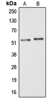 ARMC6 Antibody - Western blot analysis of ARMC6 expression in HT29 (A); COLO205 (B) whole cell lysates.