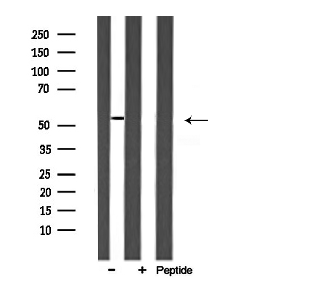 ARMC6 Antibody - Western blot analysis of ARMC6 expression in rat muscle lysate