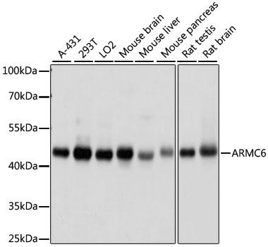 ARMC6 Antibody - Western blot analysis of extracts of various cell lines using ARMC6 Polyclonal Antibody at dilution of 1:1000.