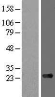 ARMC7 Protein - Western validation with an anti-DDK antibody * L: Control HEK293 lysate R: Over-expression lysate