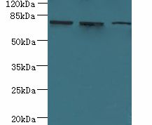 ARMC9 Antibody - Western blot. All lanes: ARMC9 antibody at 6 ug/ml. Lane 1: Jurkat whole cell lysate. Lane 2: CEM whole cell lysate. Lane 3: A549 whole cell lysate. Secondary Goat polyclonal to Rabbit IgG at 1:10000 dilution. Predicted band size: 76 kDa. Observed band size: 76 kDa.