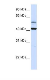 ARMCX1 Antibody - Placenta lysate. Antibody concentration: 1.0 ug/ml. Gel concentration: 12%.  This image was taken for the unconjugated form of this product. Other forms have not been tested.