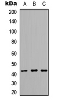 ARMCX1 Antibody - Western blot analysis of ARMCX1 expression in MCF7 (A); mouse brain (B); rat brain (C) whole cell lysates.