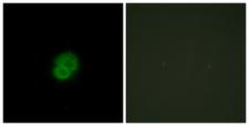 ARMCX2 Antibody - Immunofluorescence analysis of HepG2 cells, using ARMCX2 Antibody. The picture on the right is blocked with the synthesized peptide.