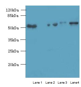 ARMCX2 Antibody - Western blot. All lanes: ARMCX2 antibody at 5 ug/ml. Lane 1: Mouse brain tissue. Lane 2: HepG-2 whole cell lysate. Lane 3: HCT116 whole cell lysate. Lane 4: MCF7 whole cell lysate. Secondary Goat polyclonal to Rabbit IgG at 1:10000 dilution. Predicted band size: 66 kDa. Observed band size: 66 kDa.